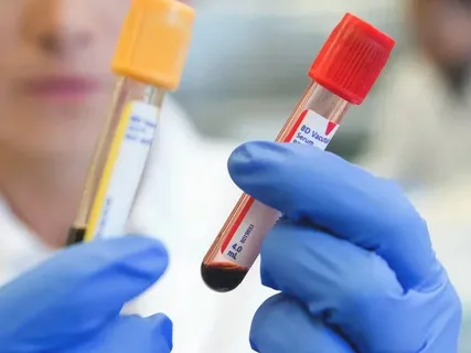 تصویر 3 از کیت تست خون مخفی به صورت تضمینی برای استفاده بیماران